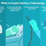 Benefits of colonoscopy screenings for colon health