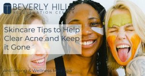 How to manage acne with skincare products